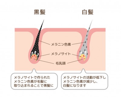 Mechanism of pigmented hair and gray hair / comparison vector il